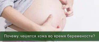 Чешется кожа у беременной