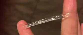 Цервикальная слизь