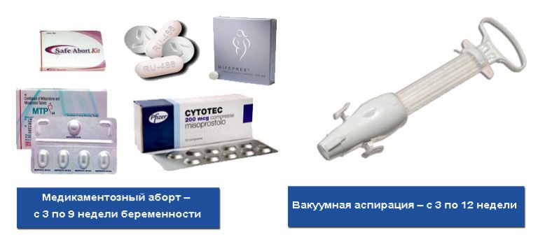 На каком сроке уже можно делать аборт и какими методами?