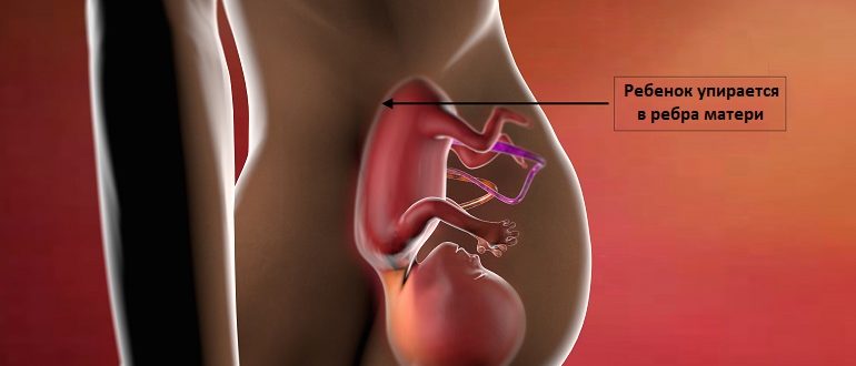 Беременность 31 неделя боли. Ребенок в утробе упирается в ребра. Плод упирается в живот.