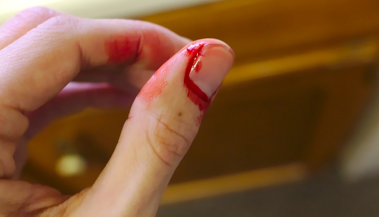 Кровь у женщины на пальцах