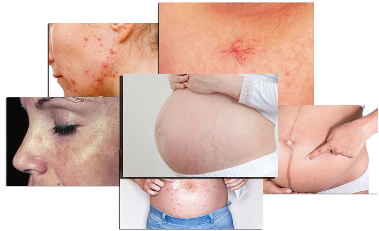 Влияние беременности на кожу и уход за кожей во время беременности. Изменение типа кожи во время беременности