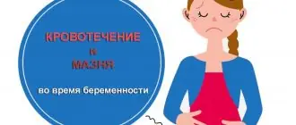 Кровотечение и мазня во время беременности