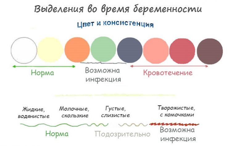 Стул черного цвета во время беременности