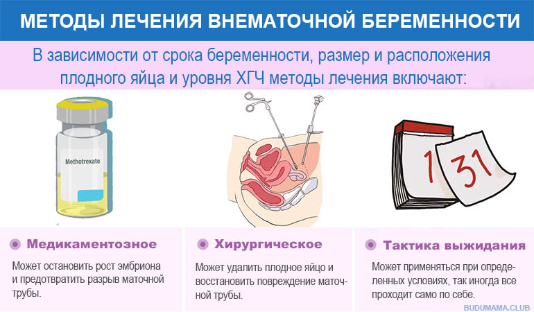 Методы лечения внематочной беременности