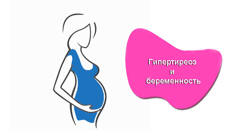 Гипертиреоз у беременной