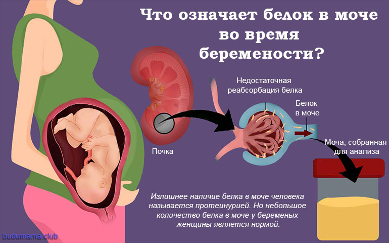 Почему появляется белок в моче у беременной женщины