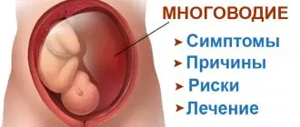 Многоводие