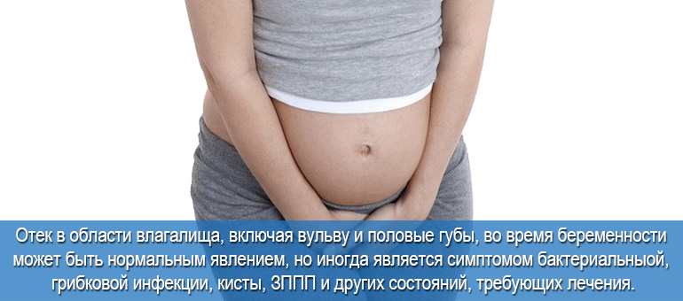 Отек влагалища при беременности