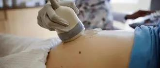 УЗИ при беременности